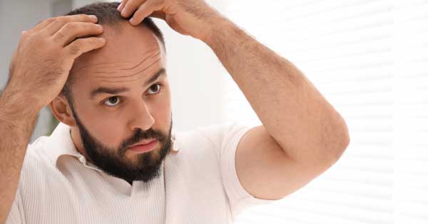 man checking hair loss